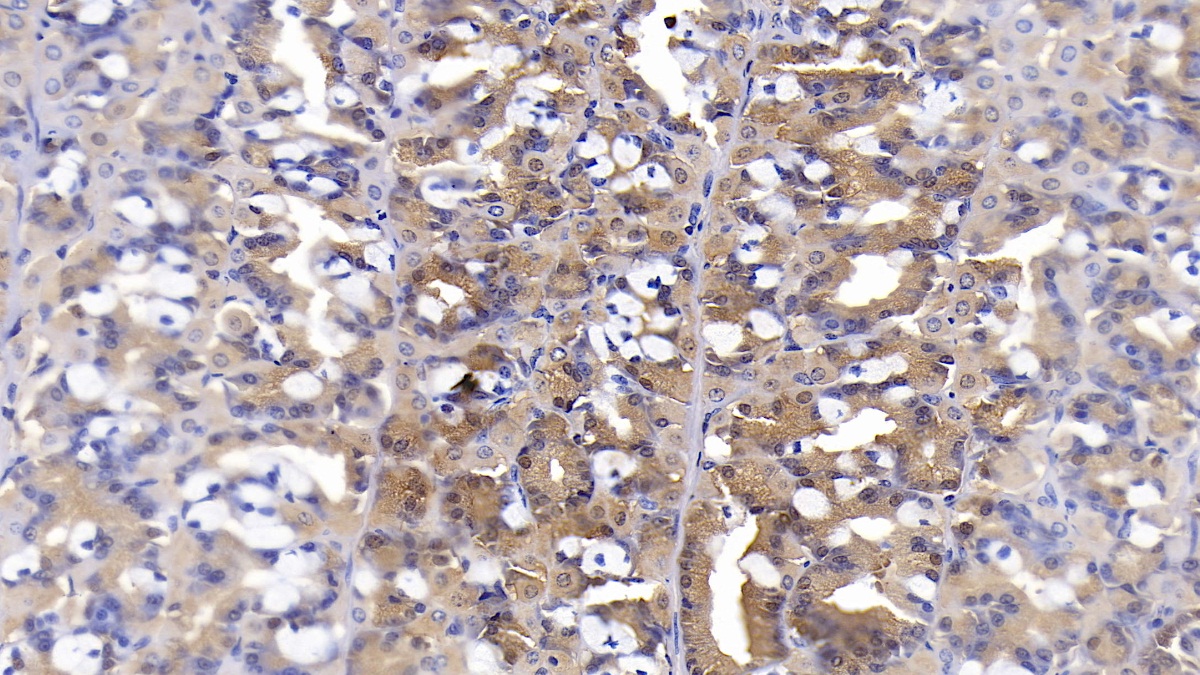 Monoclonal Antibody to Interferon Beta (IFNb)