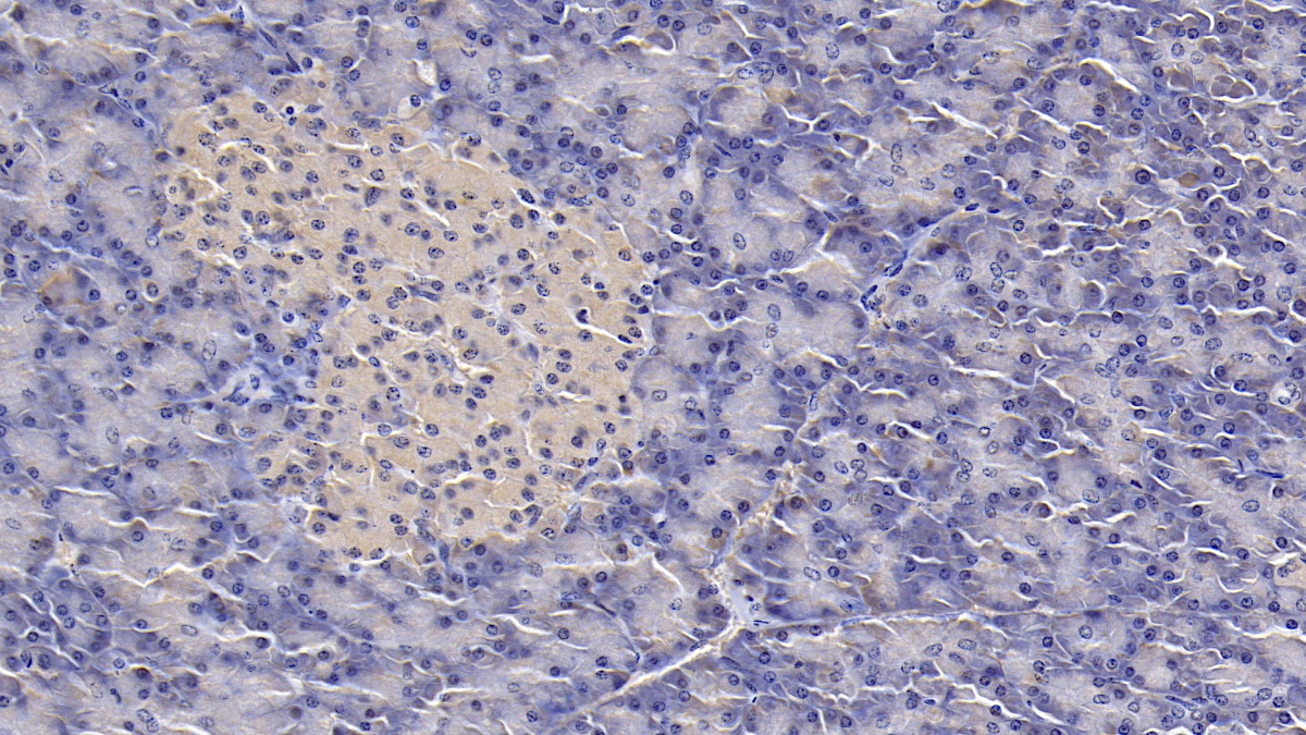 Monoclonal Antibody to Interleukin 1 Receptor Antagonist (IL1RA)