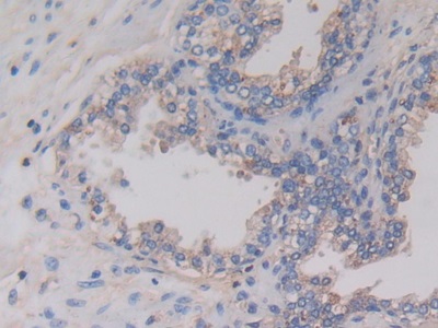 Monoclonal Antibody to Anti-Mullerian Hormone (AMH)