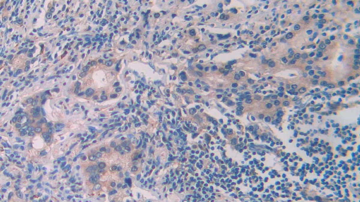 Monoclonal Antibody to Anti-Mullerian Hormone (AMH)