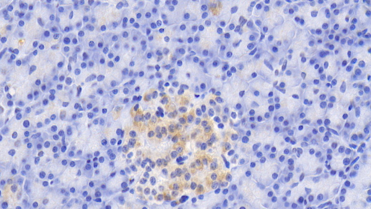 Monoclonal Antibody to Trypsin (TRY)