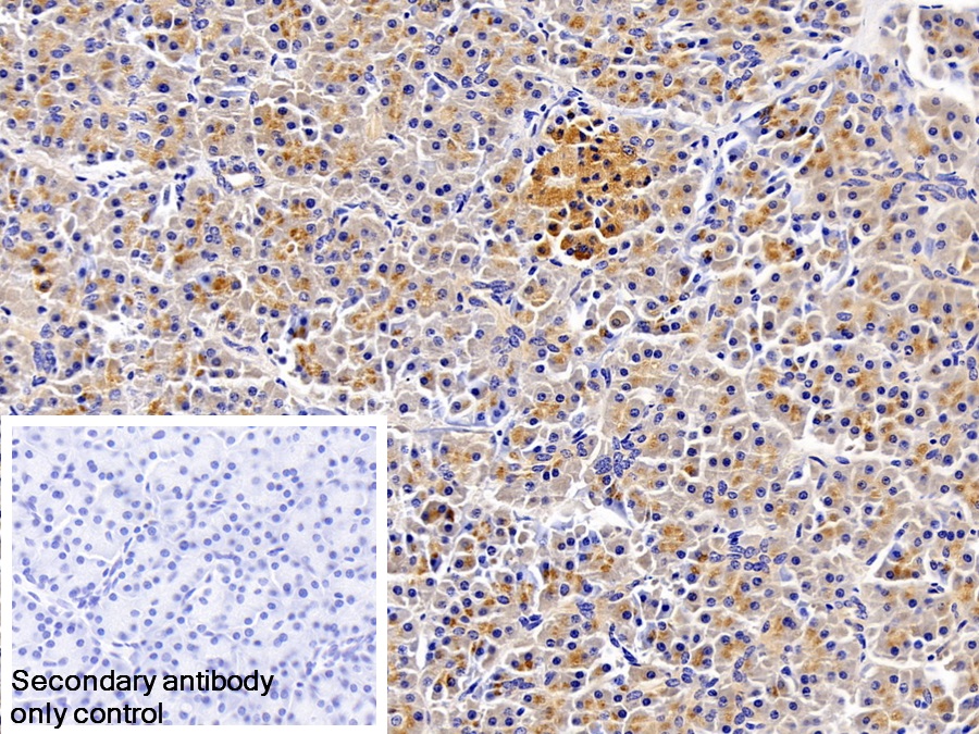 Monoclonal Antibody to Trypsin (TRY)