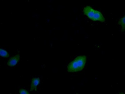 Monoclonal Antibody to Calnexin (CNX)