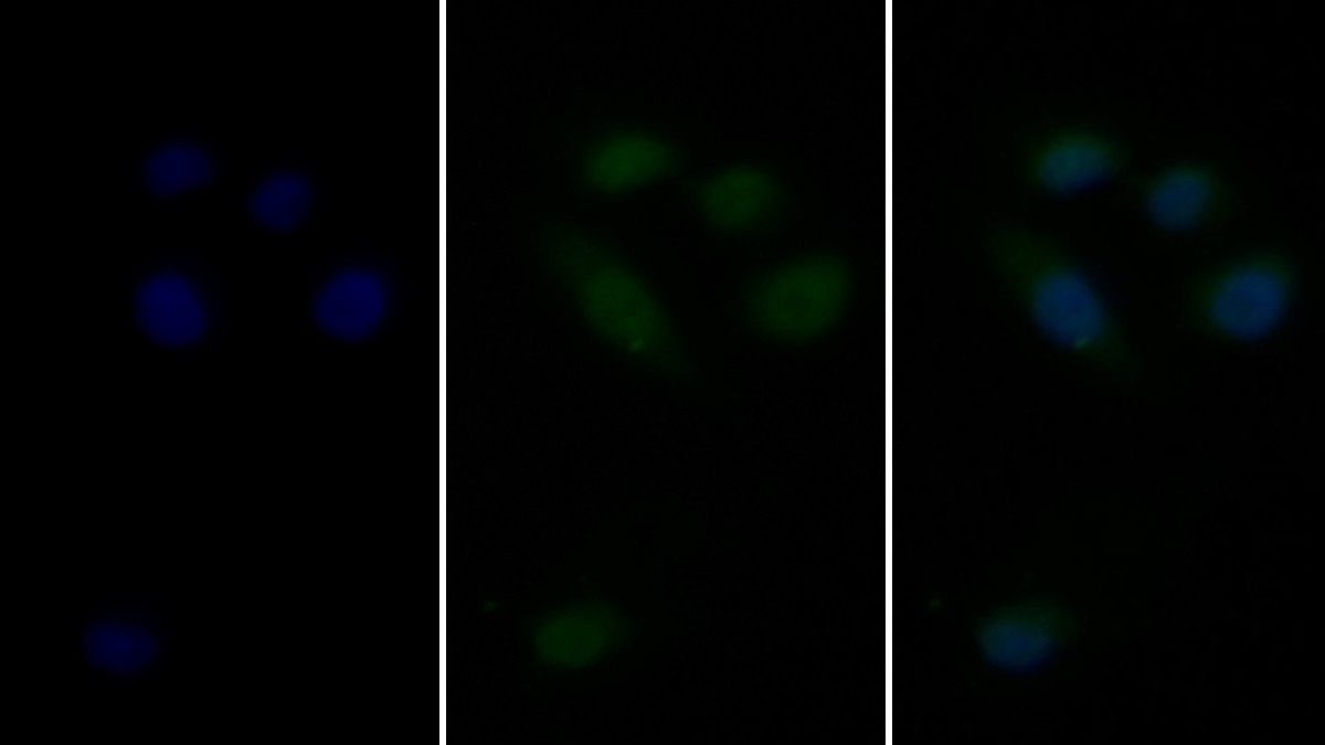 Monoclonal Antibody to Heat Shock 70kDa Protein 1B (HSPA1B)