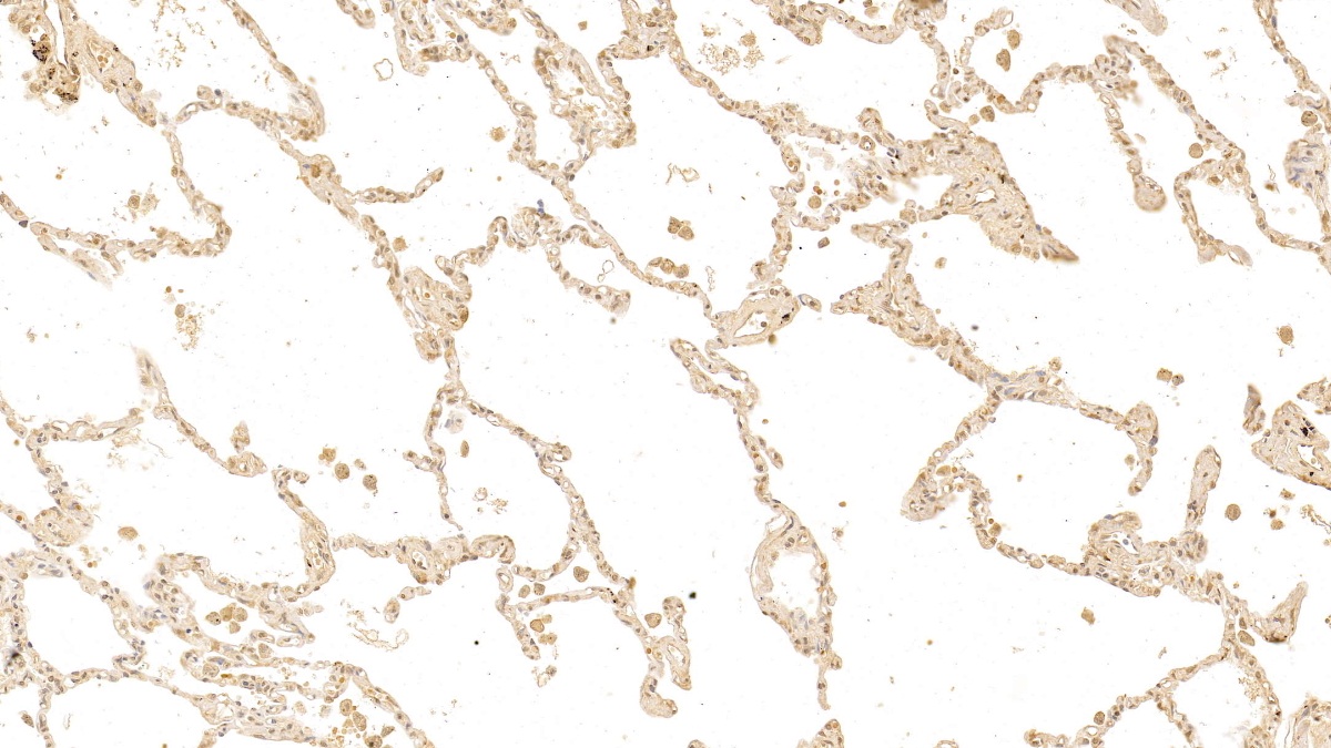 Monoclonal Antibody to Galectin 3 (GAL3)