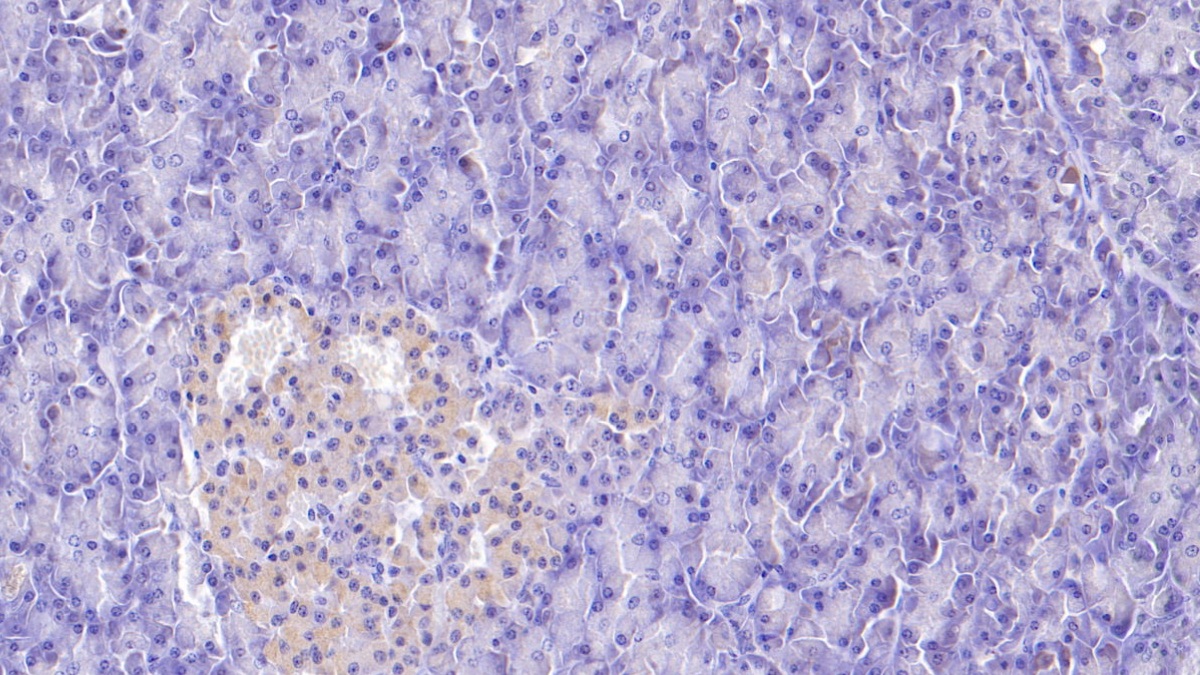 Monoclonal Antibody to Apolipoprotein H (APOH)