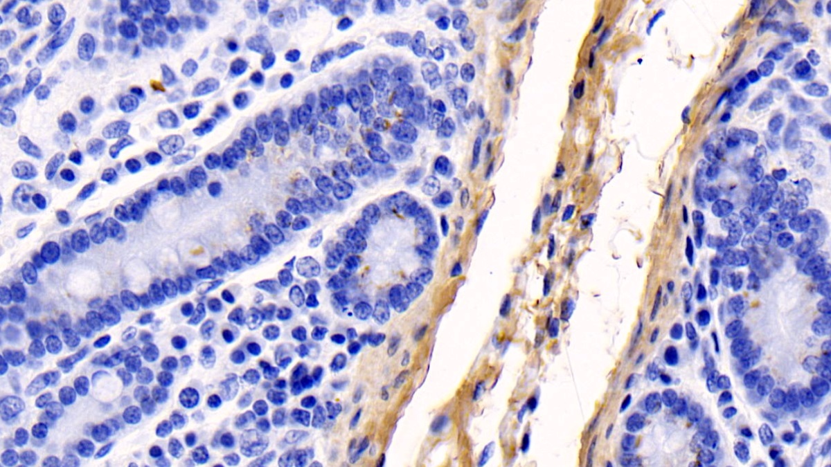 Monoclonal Antibody to Collagen Type I Alpha 1 (COL1a1)