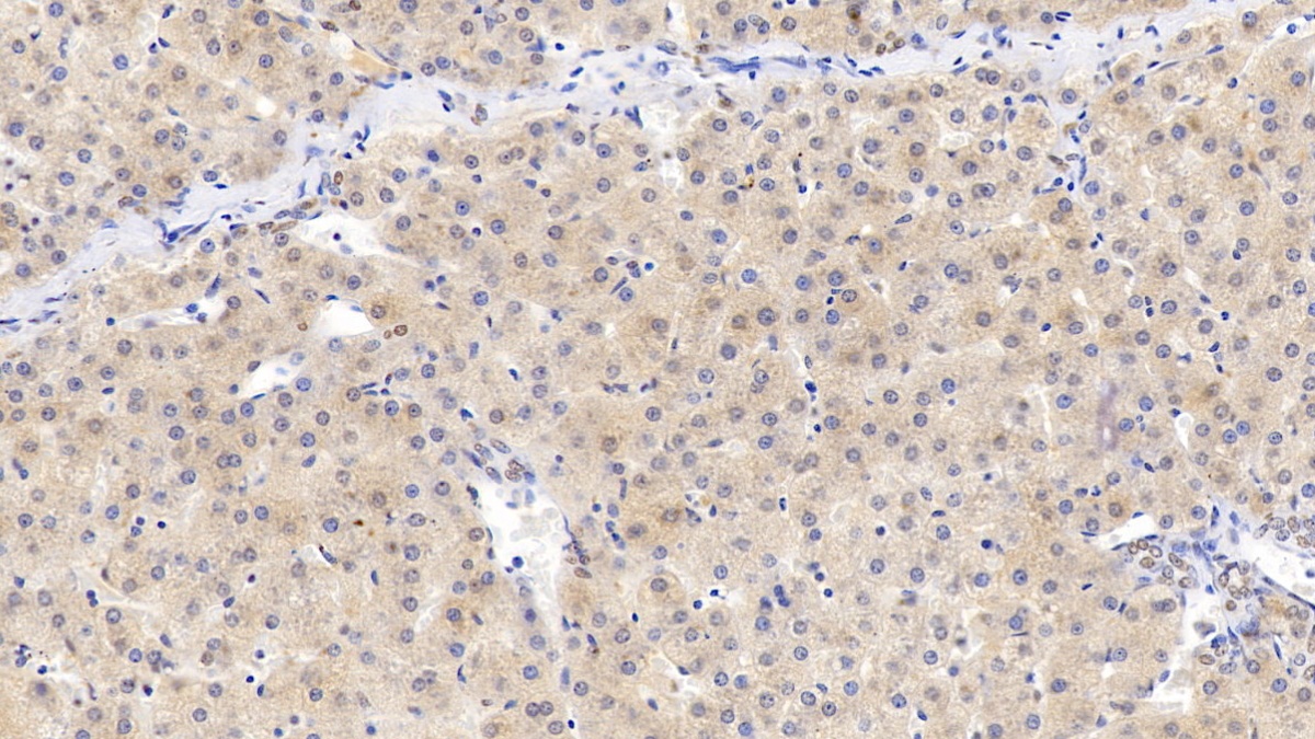 Monoclonal Antibody to Complement Component 3a (C3a)