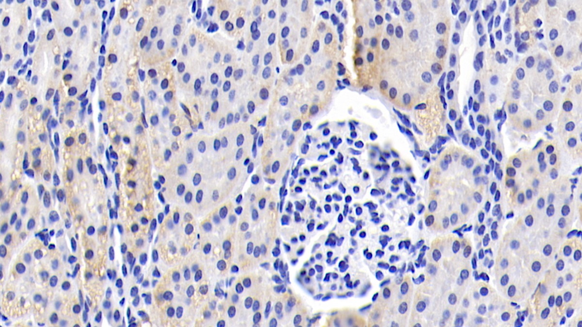 Monoclonal Antibody to Complement Component 3a (C3a)