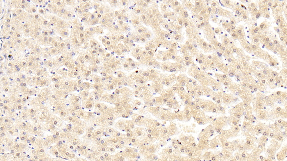 Monoclonal Antibody to Complement Component 5a (C5a)