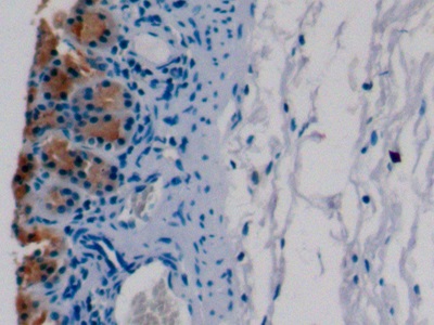 Monoclonal Antibody to Complement Component 5a (C5a)