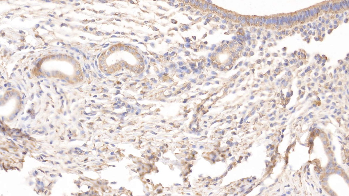 Monoclonal Antibody to Tissue Factor Pathway Inhibitor (TFPI)