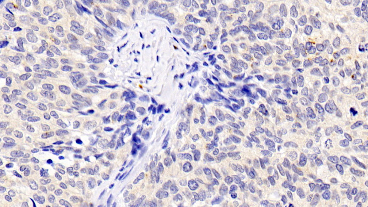 Monoclonal Antibody to Inhibin Alpha (INHa)