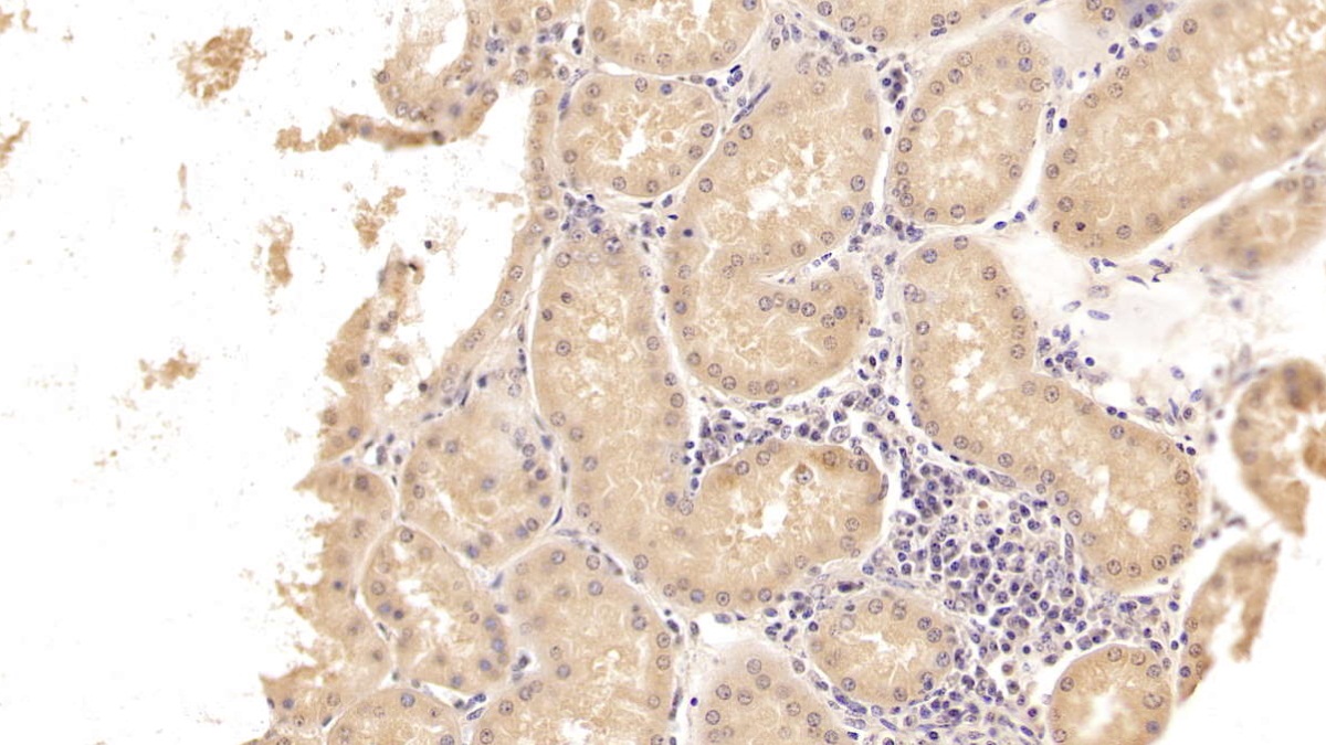 Monoclonal Antibody to Sex Hormone Binding Globulin (SHBG)