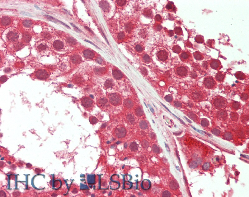 Monoclonal Antibody to Dehydroepiandrosterone (DHEA)