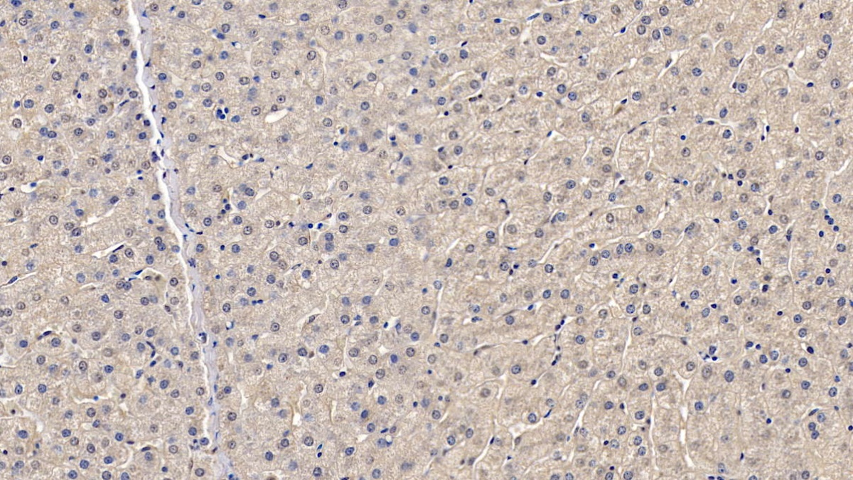Monoclonal Antibody to High Mobility Group Protein 1 (HMGB1)