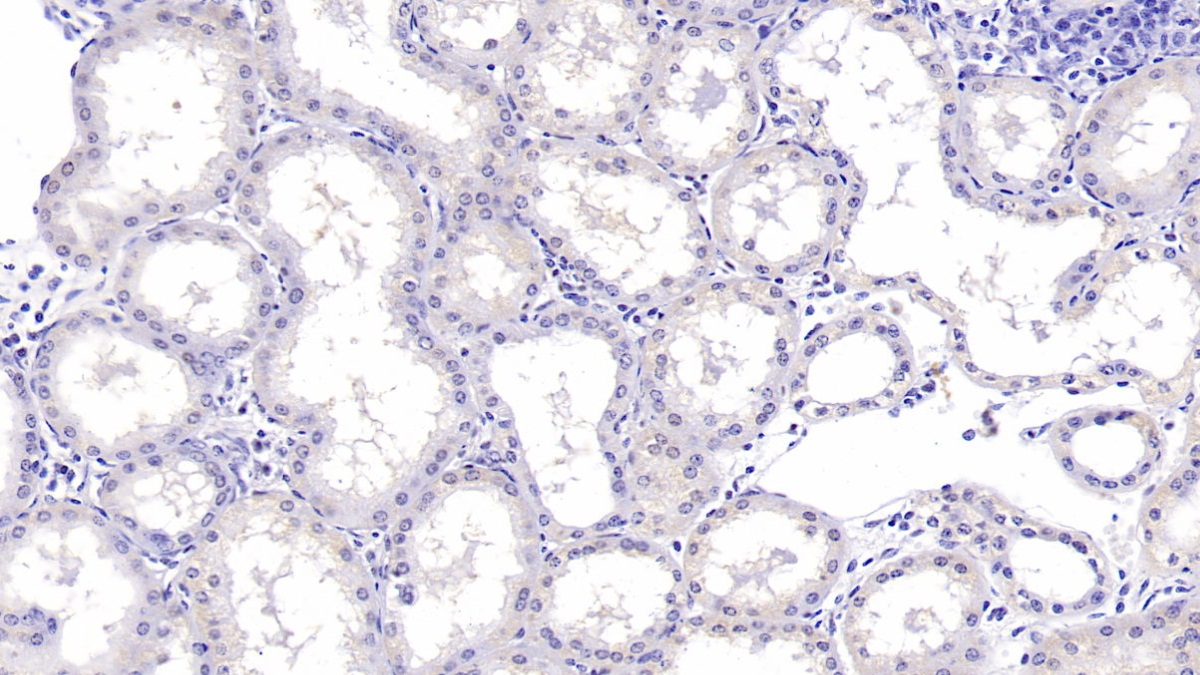 Monoclonal Antibody to Alpha-Hemoglobin Stabilizing Protein (aHSP)