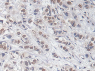 Monoclonal Antibody to Early Growth Response Protein 1 (EGR1)