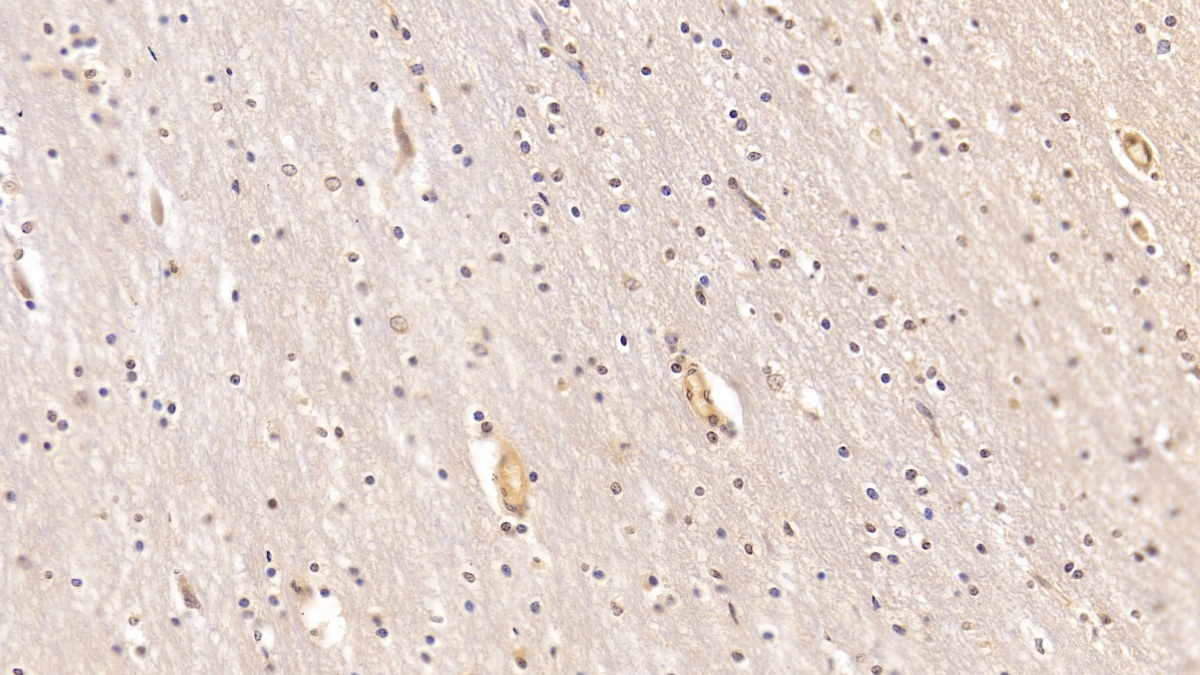 Monoclonal Antibody to Myelin Oligodendrocyte Glycoprotein (MOG)