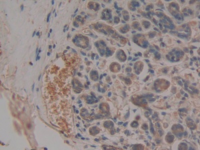 Monoclonal Antibody to Neurokinin A (NKA)