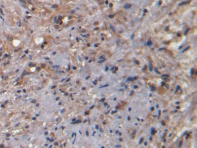 Monoclonal Antibody to Neurokinin A (NKA)