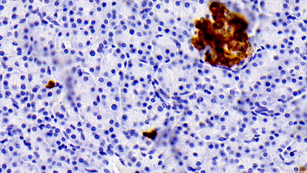 Monoclonal Antibody to Insulin (INS)