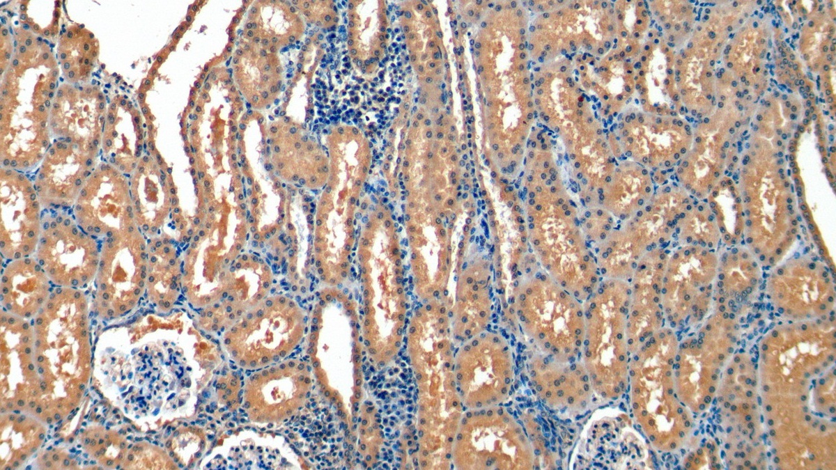 Monoclonal Antibody to Osteocalcin (OC)