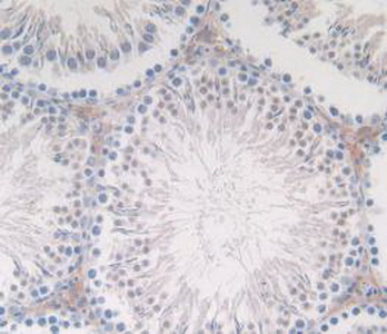 Monoclonal Antibody to Calcitonin (CT)