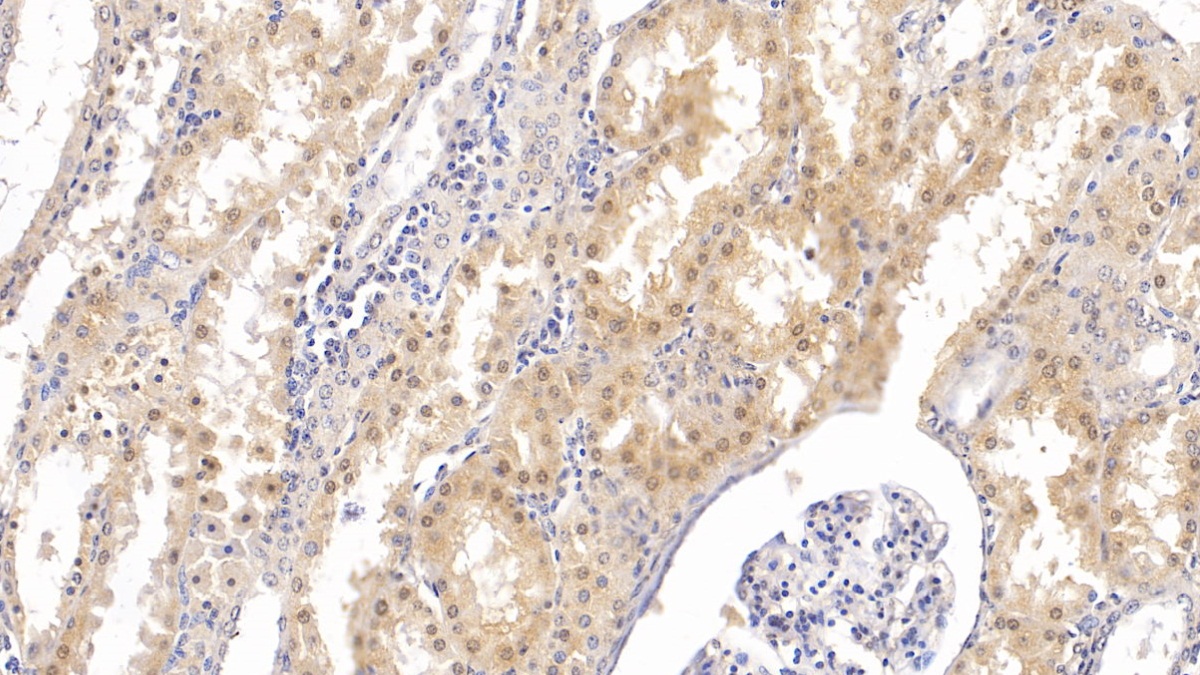 Monoclonal Antibody to Parathyroid Hormone Receptor 2 (PTHR2)