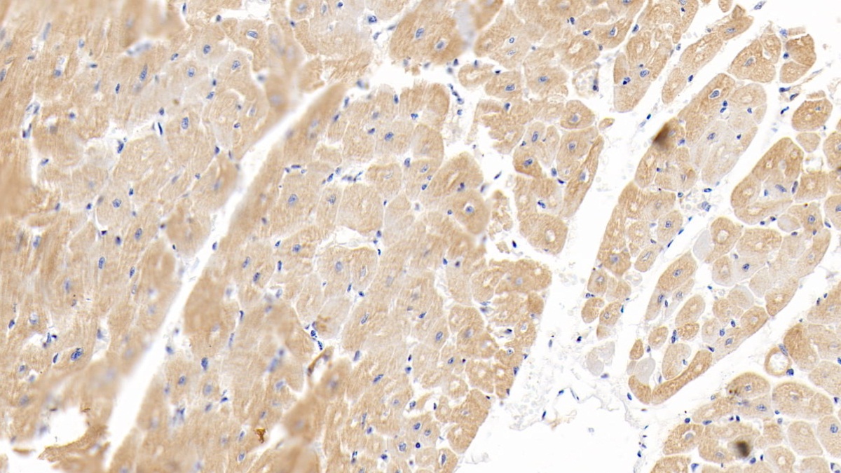 Monoclonal Antibody to Cardiac Troponin I (cTnI)