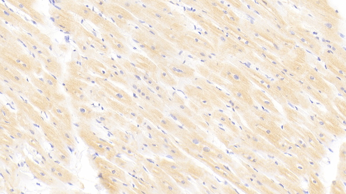 Monoclonal Antibody to Cardiac Troponin I (cTnI)