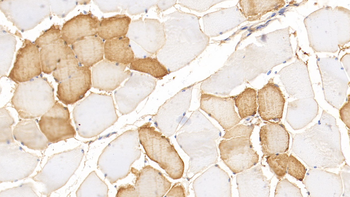 Monoclonal Antibody to Myoglobin (MYO)