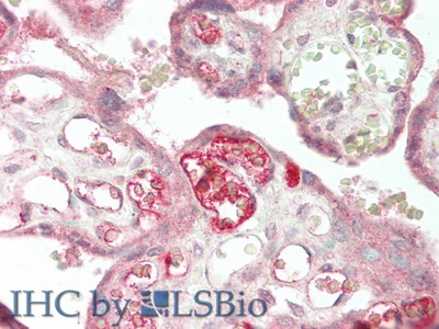 Monoclonal Antibody to Endothelin 1 (EDN1)