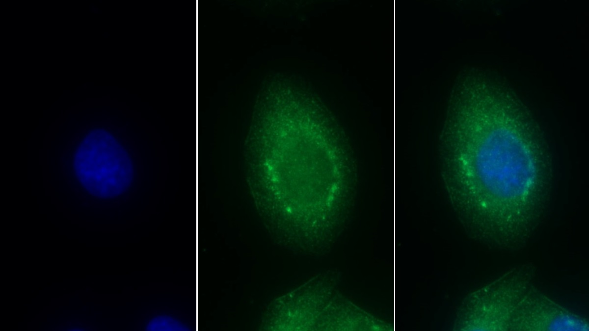 Monoclonal Antibody to Endothelin 1 (EDN1)