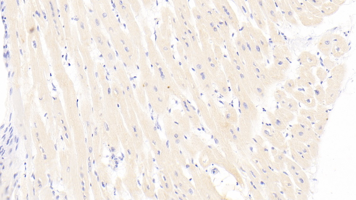 Monoclonal Antibody to N-Terminal Pro-Brain Natriuretic Peptide (NT-ProBNP)