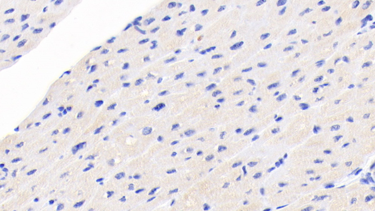 Monoclonal Antibody to N-Terminal Pro-Brain Natriuretic Peptide (NT-ProBNP)