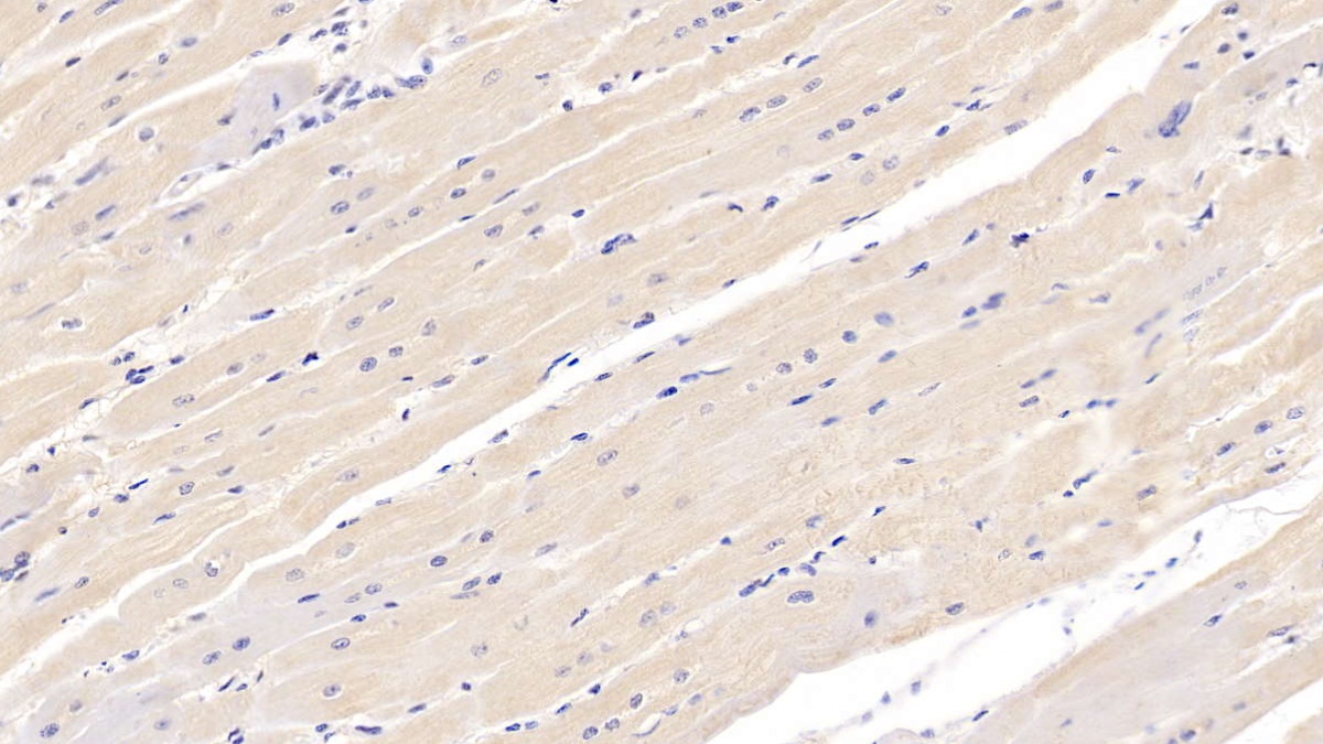 Monoclonal Antibody to N-Terminal Pro-Brain Natriuretic Peptide (NT-ProBNP)