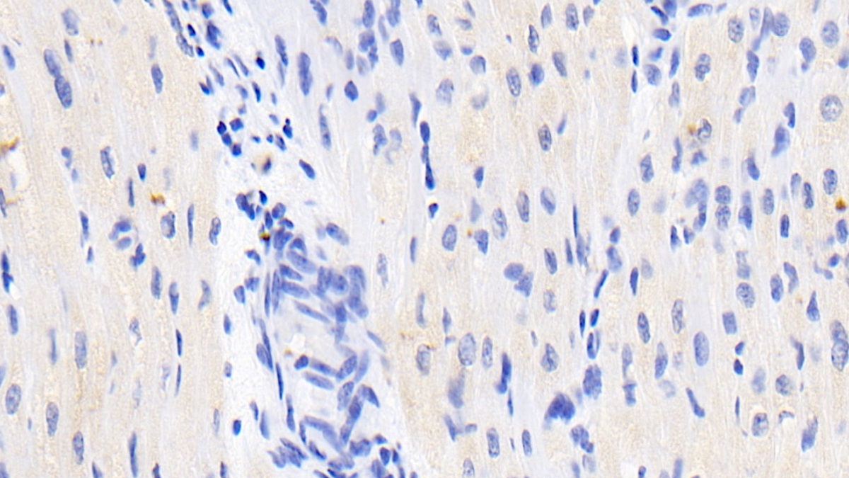 Monoclonal Antibody to N-Terminal Pro-Brain Natriuretic Peptide (NT-ProBNP)