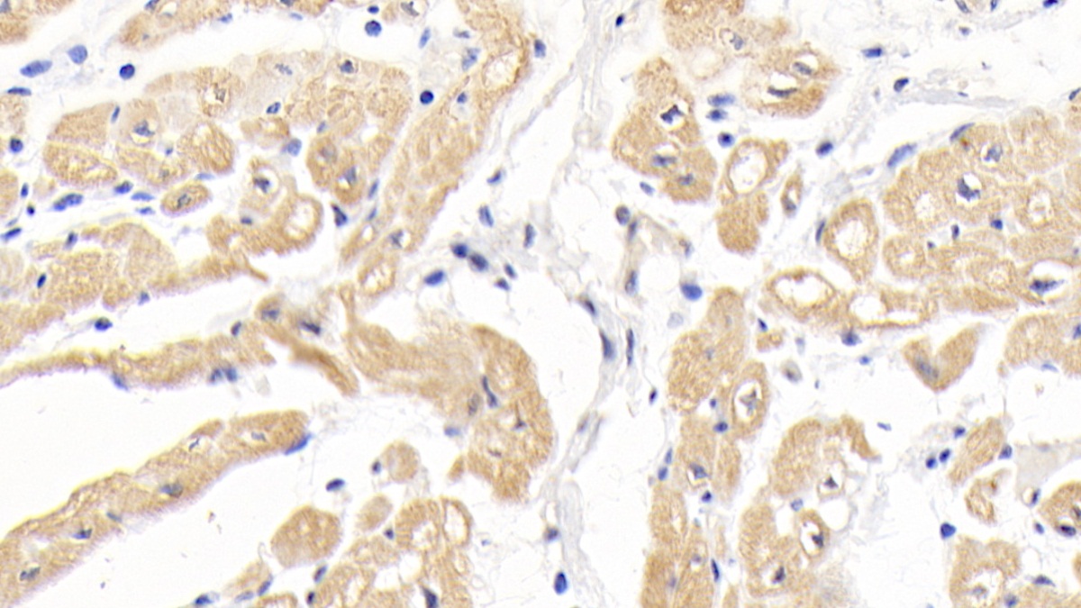 Monoclonal Antibody to N-Terminal Pro-Brain Natriuretic Peptide (NT-ProBNP)