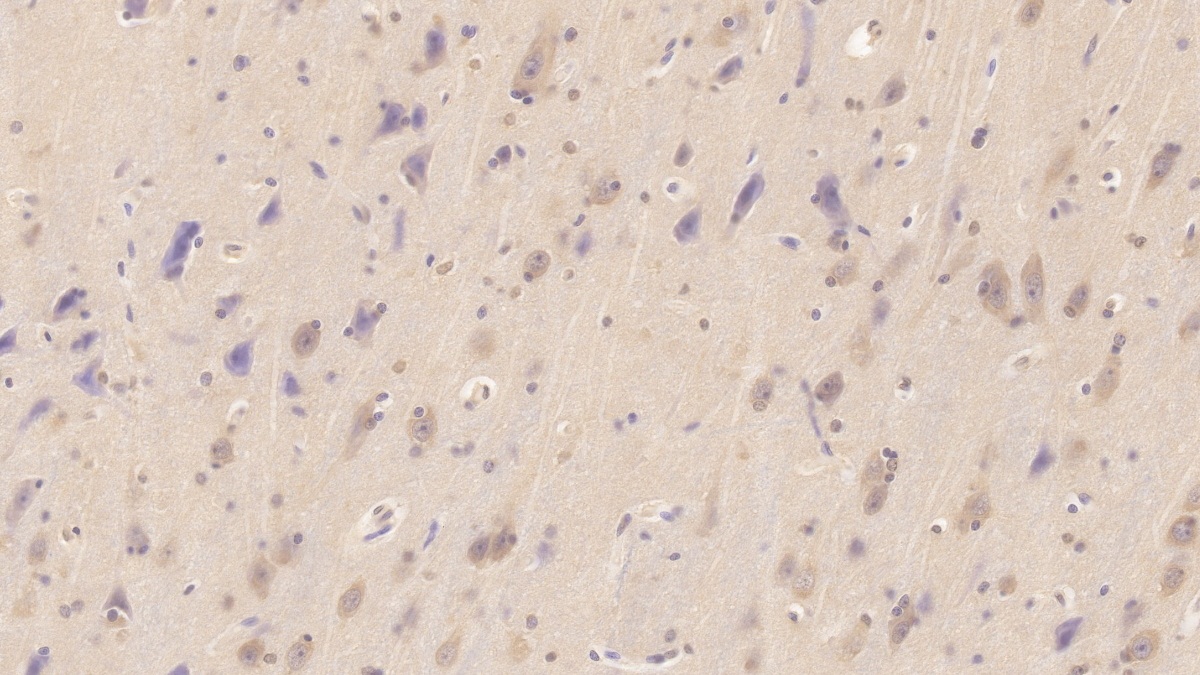 Monoclonal Antibody to N-Terminal Pro-Brain Natriuretic Peptide (NT-ProBNP)