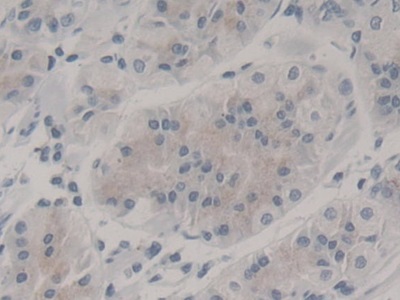 Monoclonal Antibody to Nestin (NES)