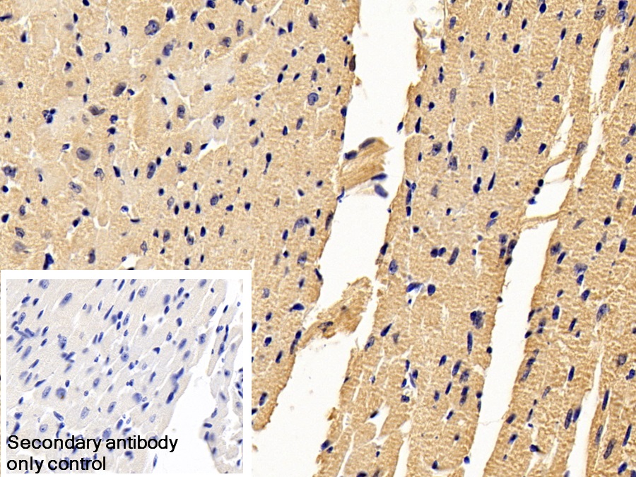 Monoclonal Antibody to Natriuretic Peptide Precursor B (NPPB)