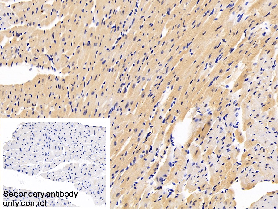 Monoclonal Antibody to Natriuretic Peptide Precursor B (NPPB)