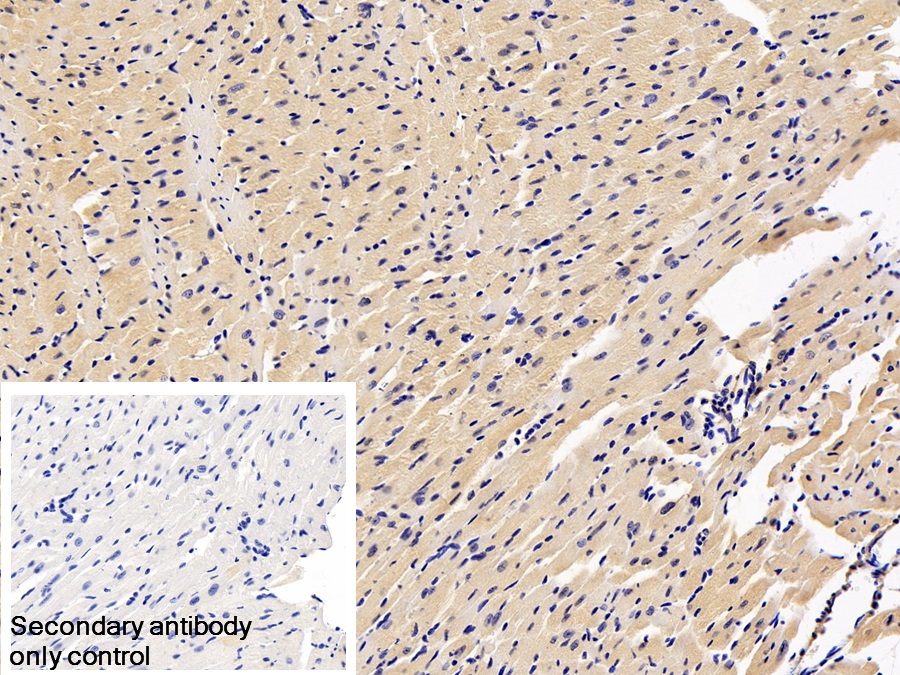 Monoclonal Antibody to Natriuretic Peptide Precursor B (NPPB)