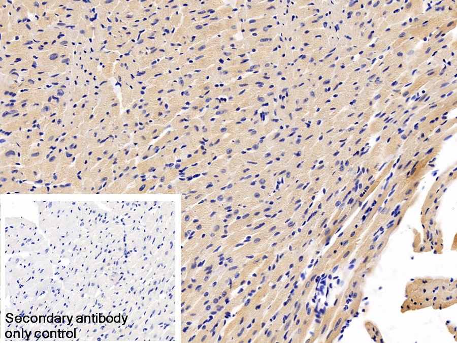 Monoclonal Antibody to Natriuretic Peptide Precursor B (NPPB)