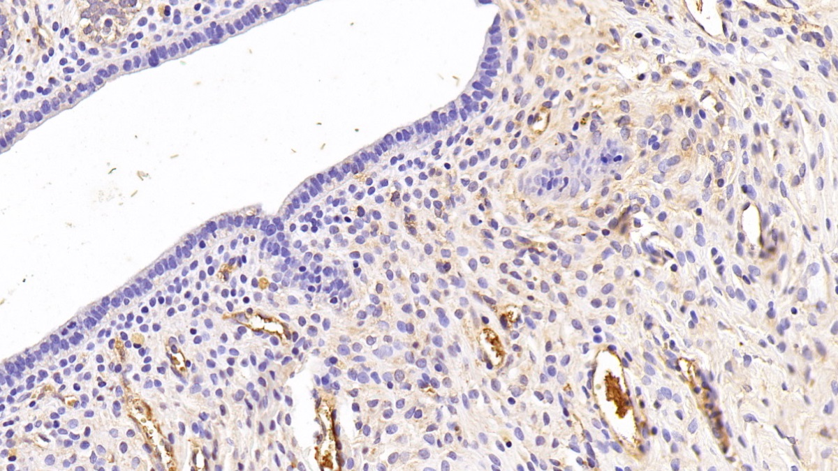 Monoclonal Antibody to Apolipoprotein A1 (APOA1)