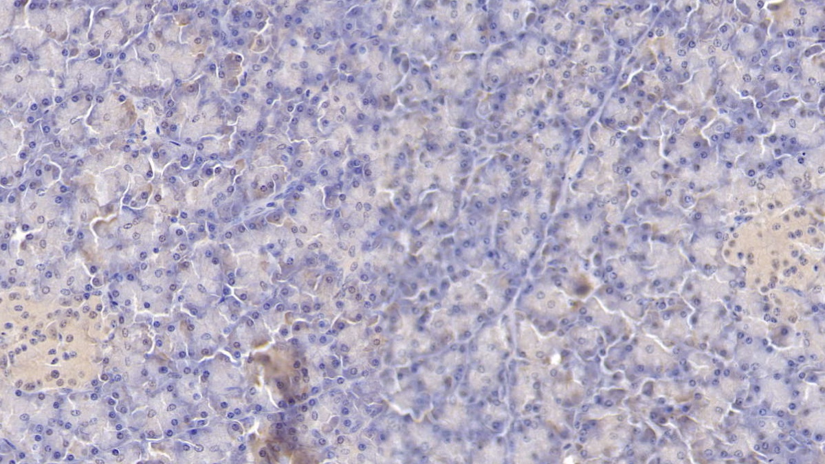 Monoclonal Antibody to Tissue Factor (TF)