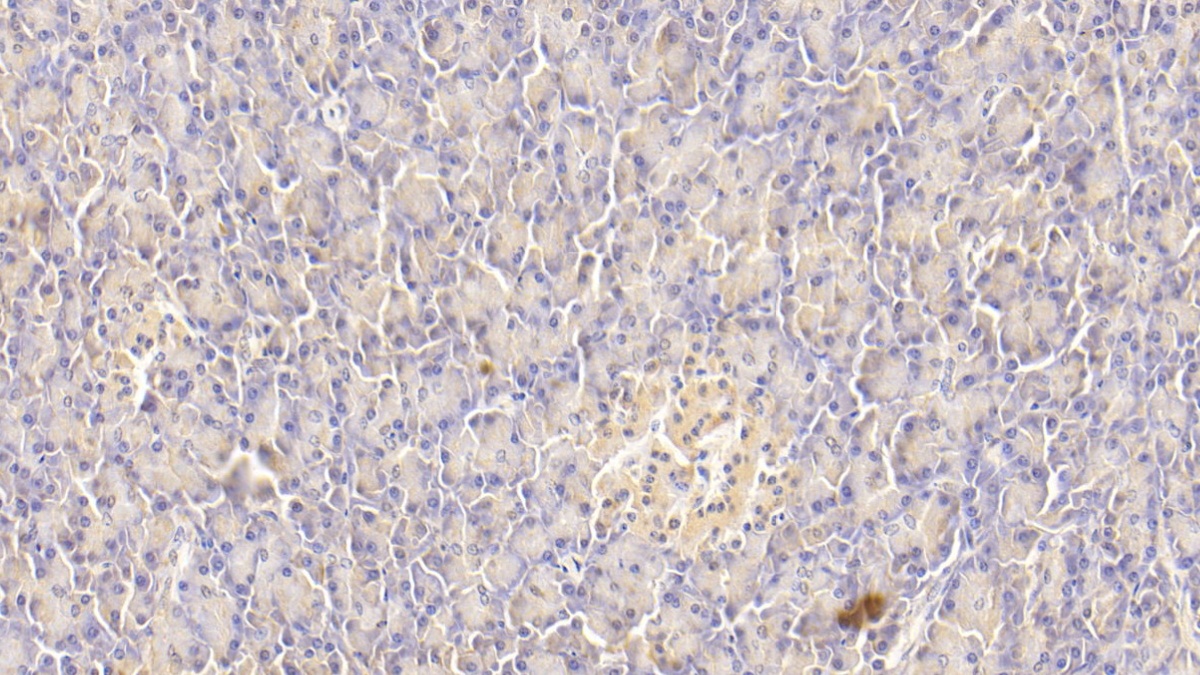 Monoclonal Antibody to Tissue Factor (TF)