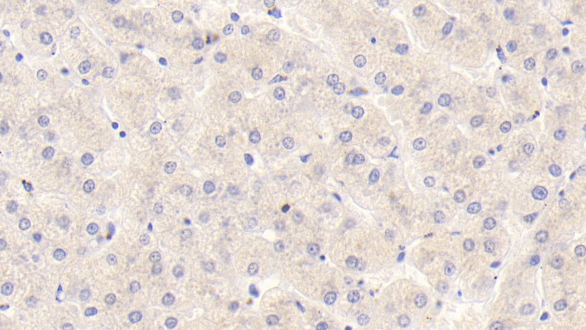 Monoclonal Antibody to Thrombomodulin (TM)