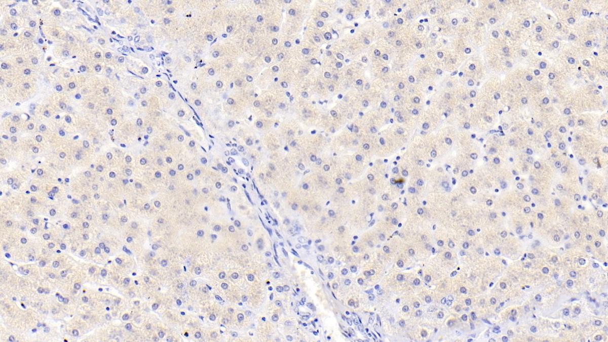 Monoclonal Antibody to Thrombomodulin (TM)